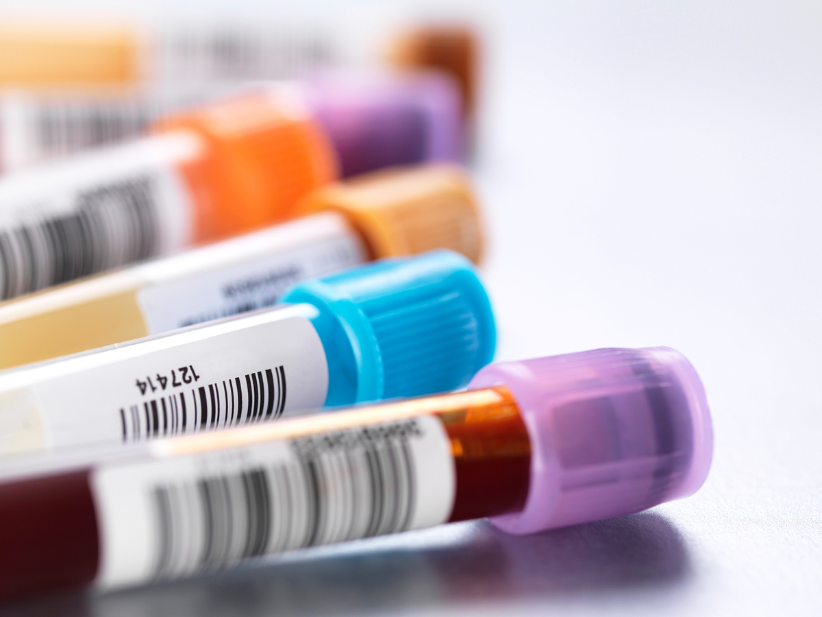 真空采血管的性能驗(yàn)證