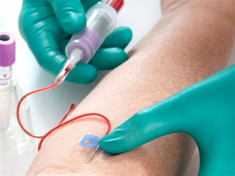 中國(guó)真空采血管發(fā)展歷史及現(xiàn)狀